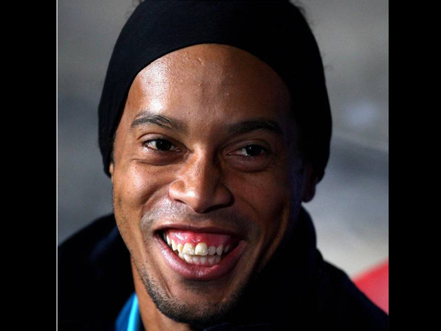 Ronaldinho Jalani Operasi Gigi